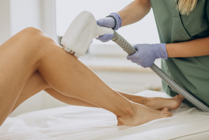 Técnica de depilação a Laser - Lamego